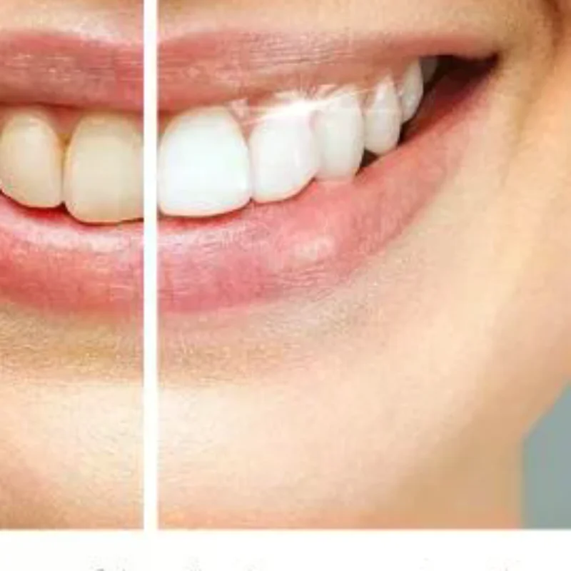 

Coconut Mint Oil Mouthwash Kit With Tongue Scraper Fresh Oral Cleaning Care Oral Periodontal Hygiene Remove Yellow Remove Stain