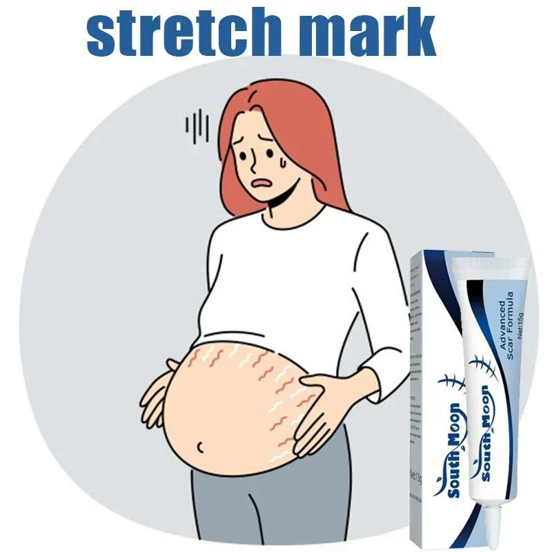 HOT~Pregnancy Stretch Repair Cream, Eliminates Postpartum Wrinkles, Lightens Growth Lines and Obesity, Repairs Wrinkles Stretch