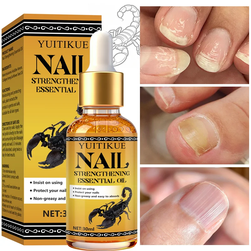 YUITIKUE Huile de renforcement des ongles, protège vos ongles à usage consistant, non grasse et facilement absorbante