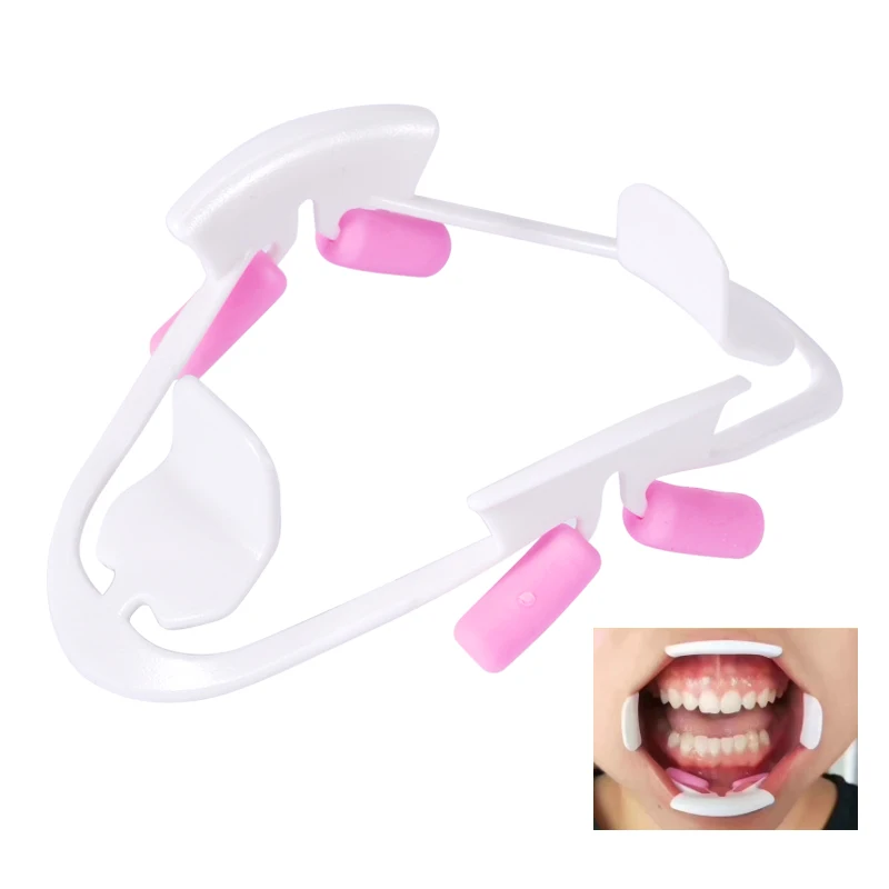 1 قطعة ثلاثية الأبعاد فتاحة الفم الأسنان الشفاه الخد ضام نقالة أداة فحص الفم 2 ألوان مادة طب الأسنان
