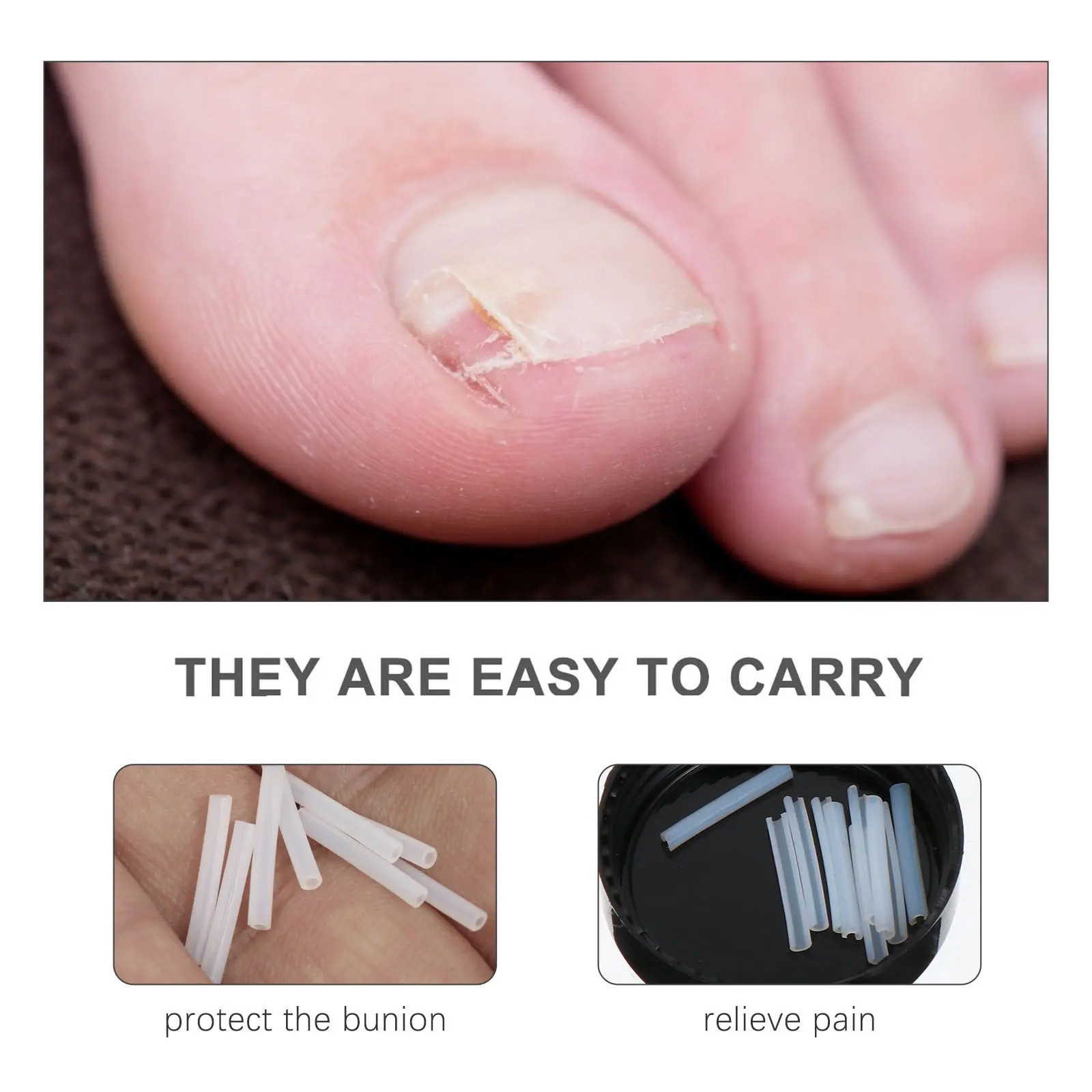 

Ingrown Toenail Tools Curved Decals Groove Sleeves Patches Stickers Nail Inlay Casing ABS Material Toe Nail Repairing Foot