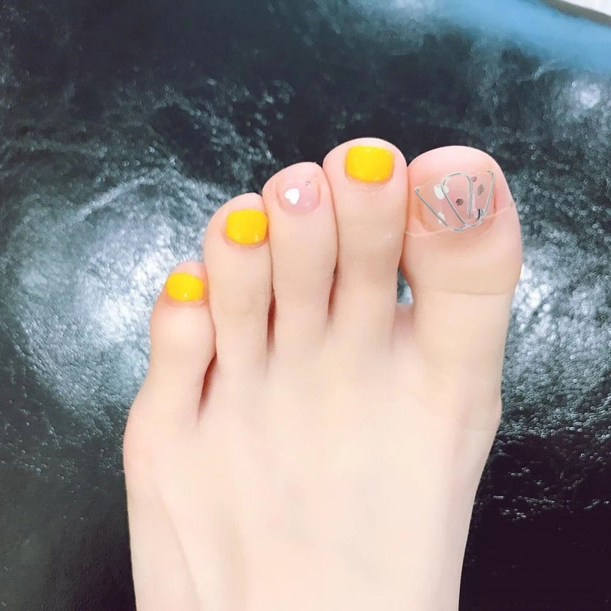 

Toenail Corrector Silver Foot Care Tool Professional Toe Nail Straighteners Orthotics Durable Use Prevent Ingrown