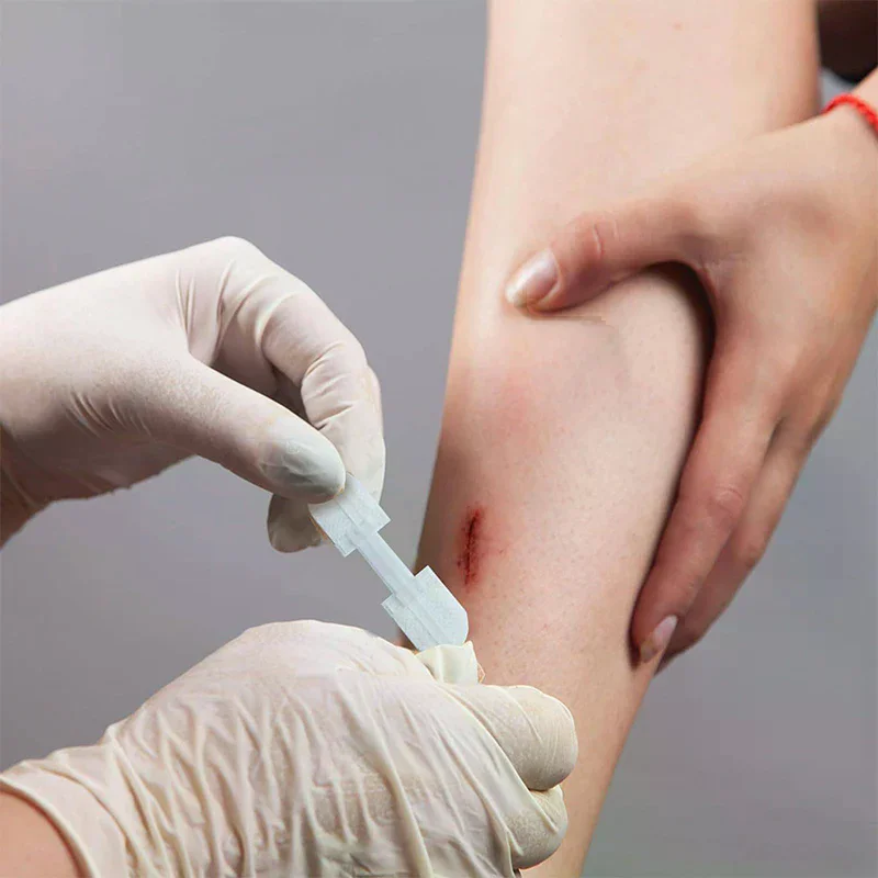 

[H]Zipper Band-aid Painless Wound Closure Patch Suture-free Wound Dressing Patches Zip Suture Reducer Band Aid Outdoor Portable