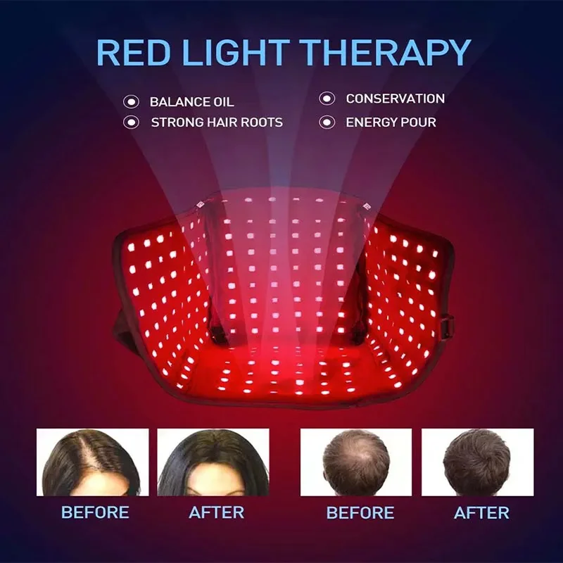 Sombrero de terapia física con luz roja LED para la pérdida de cabello, promueve el crecimiento rápido del cabello, 660nm y 850nm