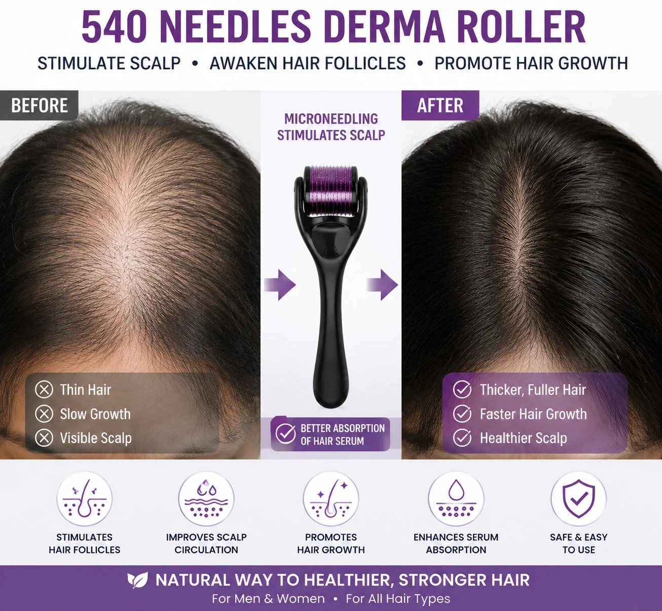 medically-sterile-derma-roller-540-needles-02mm-025mm-03mm-titanium-microneedle-hair-growth-promote-essence-absorption