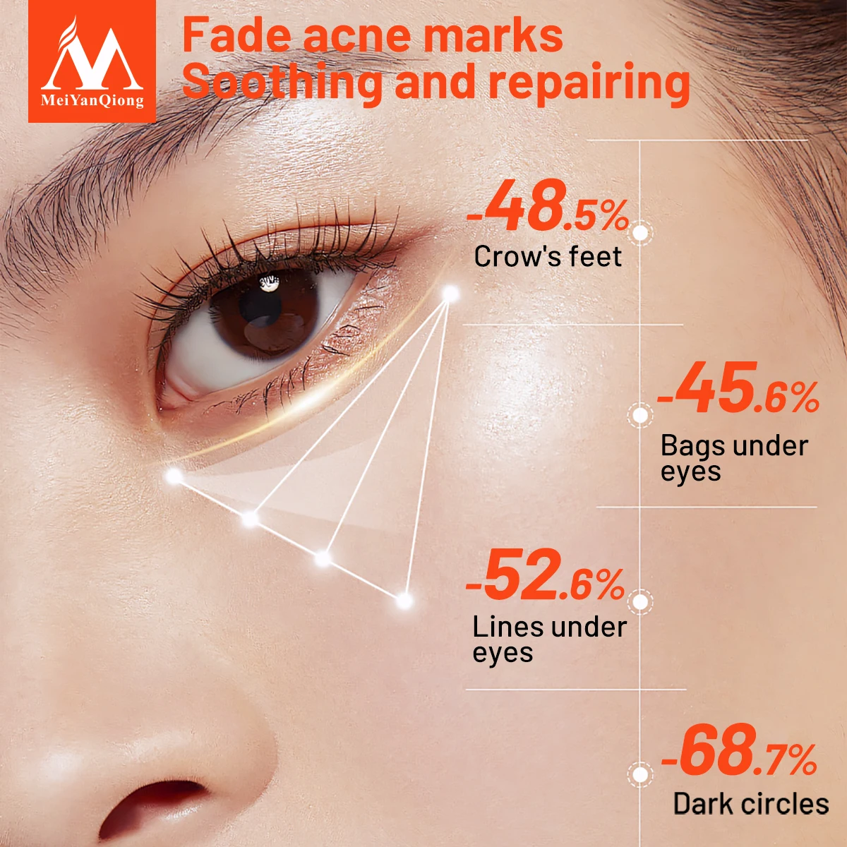 アンチエイジング アイ クリーム ペプチド コラーゲン 抗シワ アンチエイジング 美白 目のラインの除去 くまの除去 むくみの除去