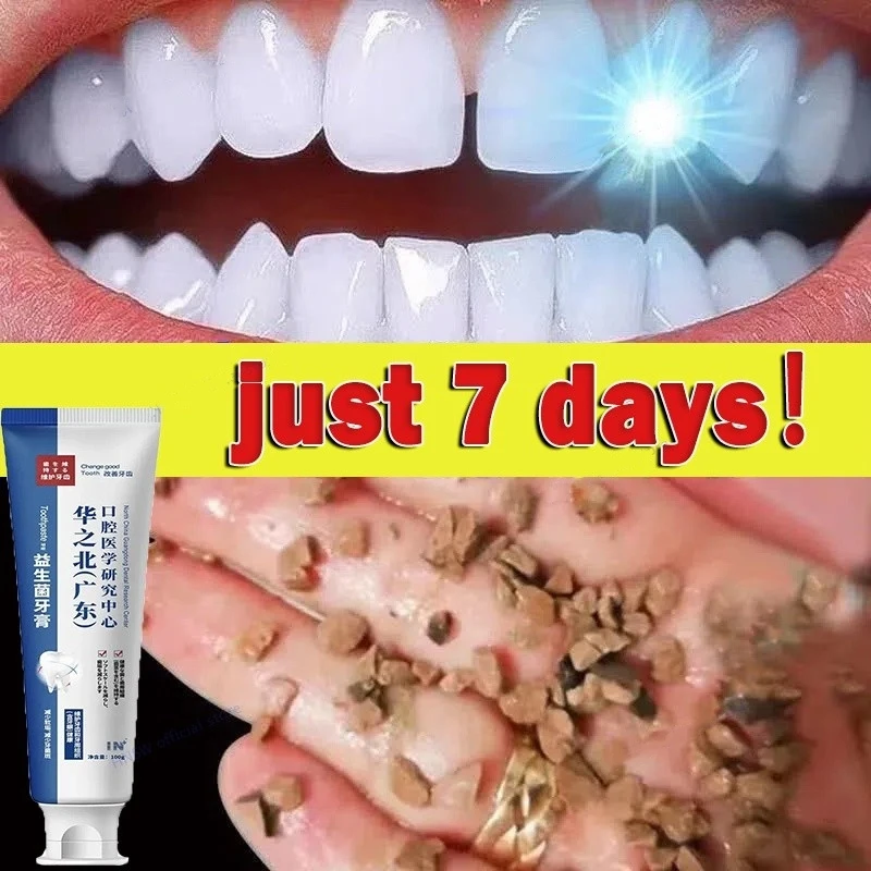 100g Quick Repair Of Cavities Caries Removal Of Plaque Stains Decay Whitening Yellowing Repair Teeth Teeth Whitening 2024 New