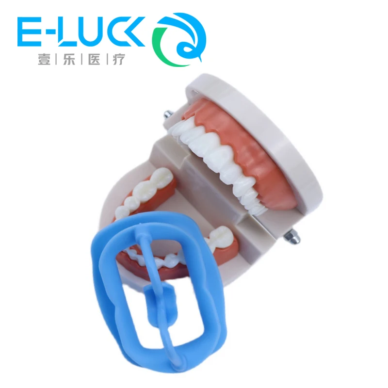 1Pc Tandheelkundige Mondopener Siliconen Wang Retractor Orthodontisch Zacht Silicium Intraorale Lip Mondverzorging