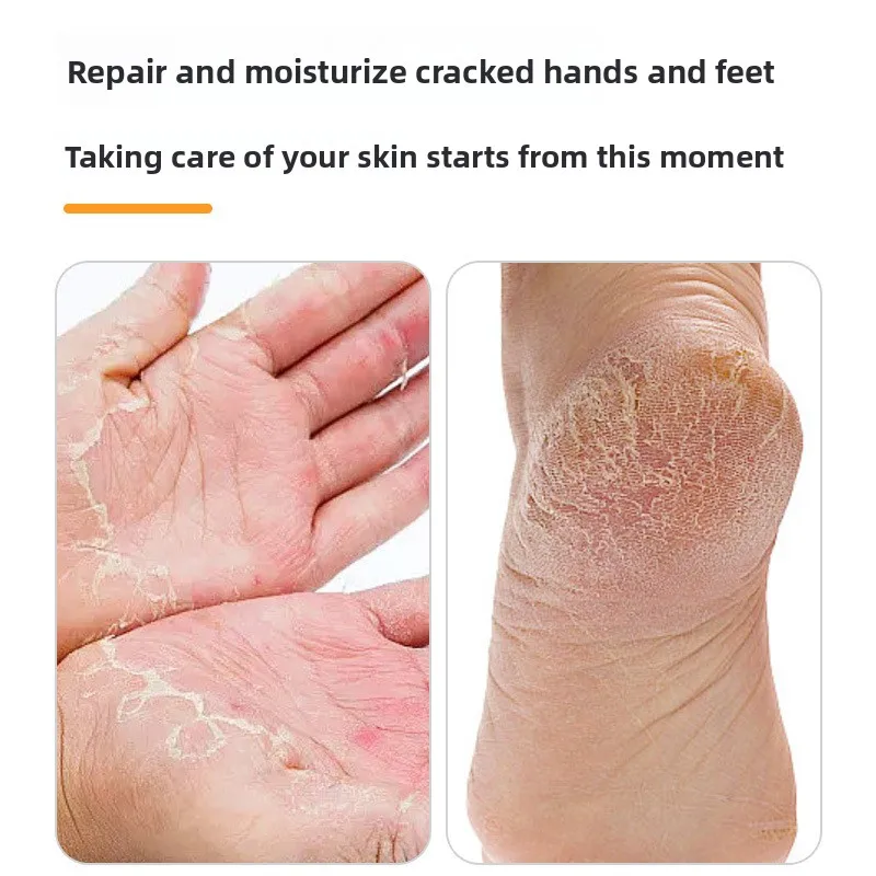 

Independently packaged crack patch for autumn and winter cracked anti-wear pressure-sensitive adhesive tape for dry cracked