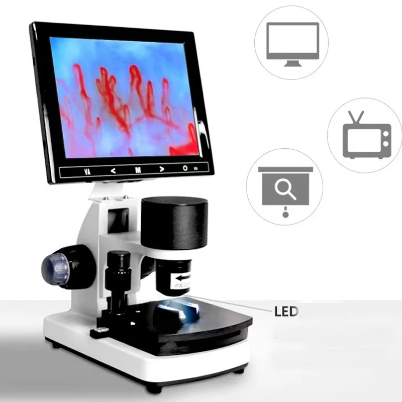 Wholesale NailFold Capillaroscopy Microcirculation Blood Capillary Microscope