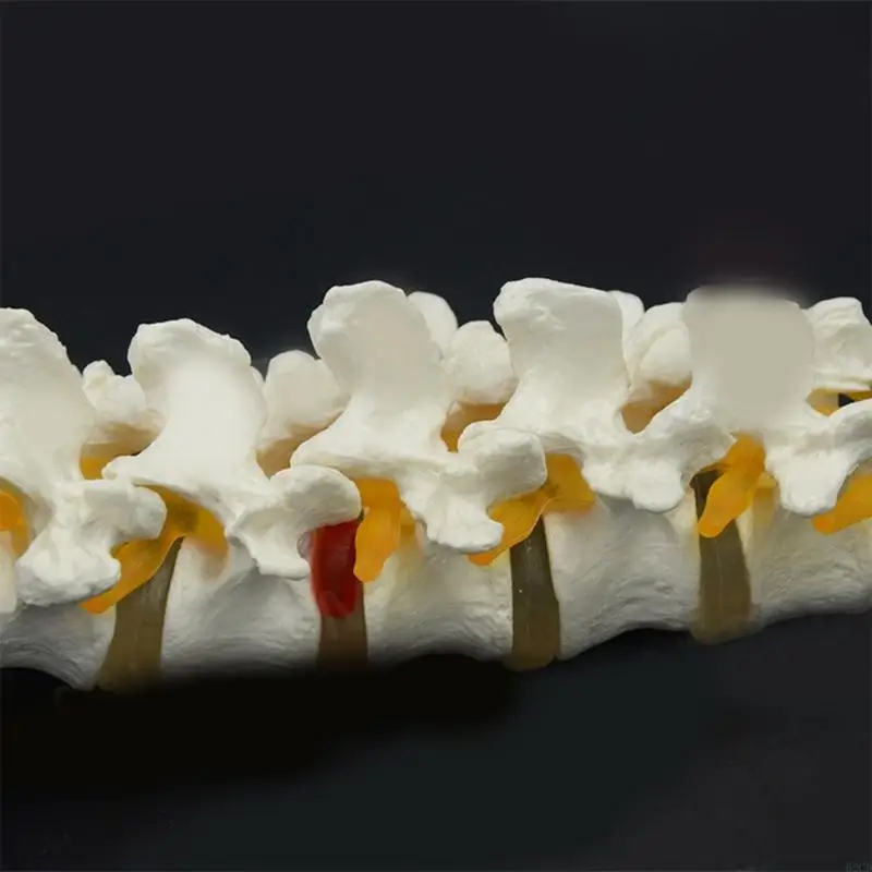 Anatomical Lumbar Spine Model Human Lumbar Vertebrae Model with 5 Vertebrae Sacrum and Spinal Nerves for Demonstrating