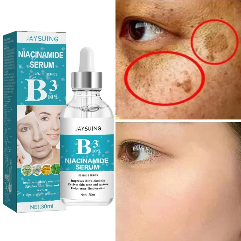 

Niacinamide Serum 30ml Moisturizing Prevent Dryness Facial Essential Oil Increasing Elasticity Smooth Soften Skin Care