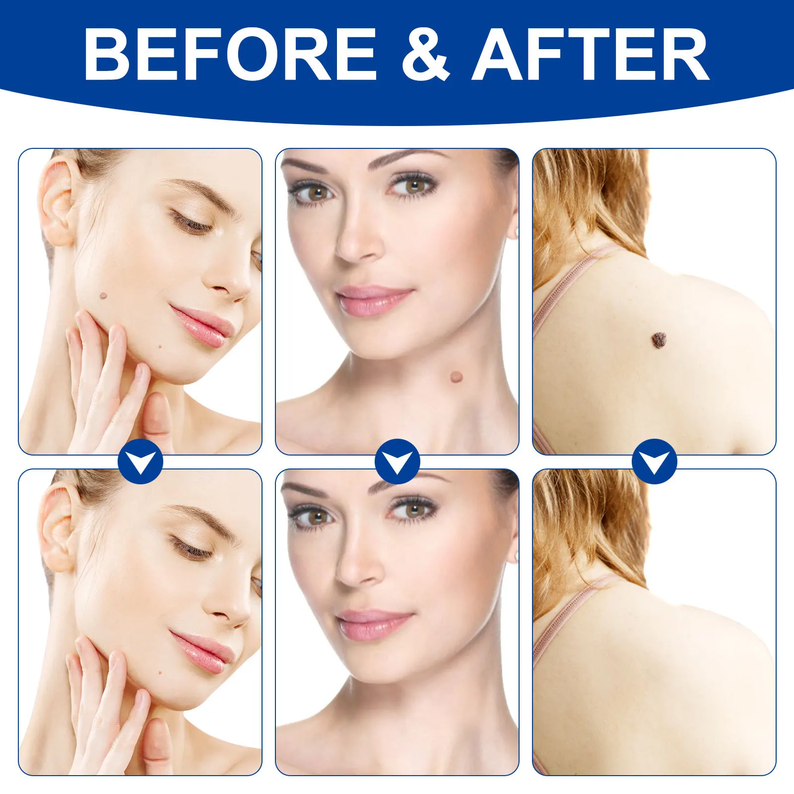 Strumento di bellezza Rimozione etichette per la pelle Talpe Tamponi detergenti efficienti Rimozione foglie sicure Pelle liscia e chiara Delicata sulla pelle Vendita calda