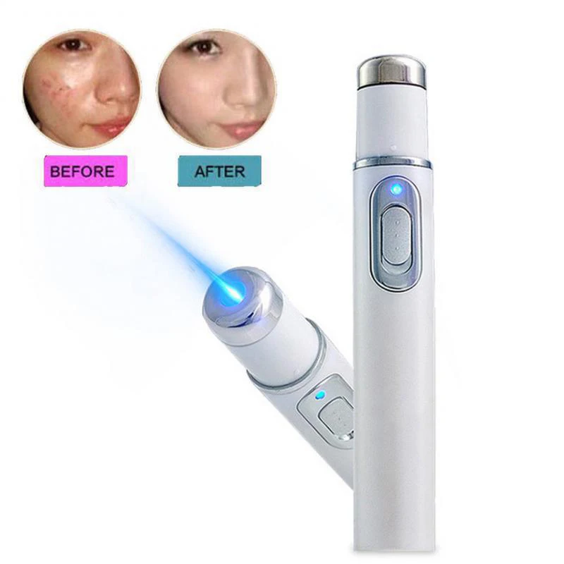 Mole And Wart Removal Pen Easy To Use Wart Eliminator Mole Nevus Remover Pen For Common Warts Skin Tags