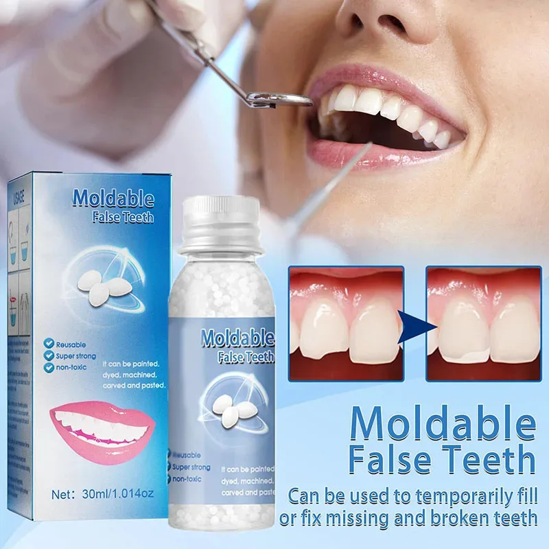 5-100g Resin Tooth Repair Glue Shapeable Teeth Gaps Filling Solid Glue Temporary Teeth Repair Falseteeth Glue Dental Supplies