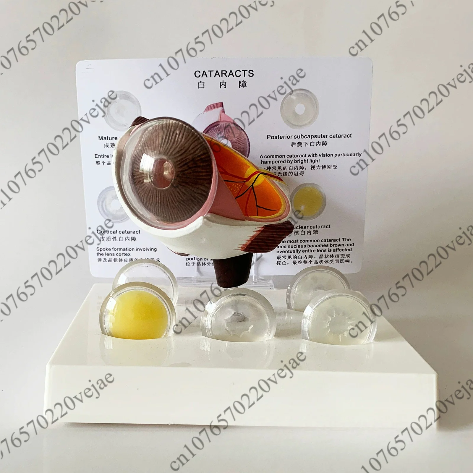 Corneal Eyeball Model Human Eye Model Medical Teaching Prop Anatomy Medical Teaching Model