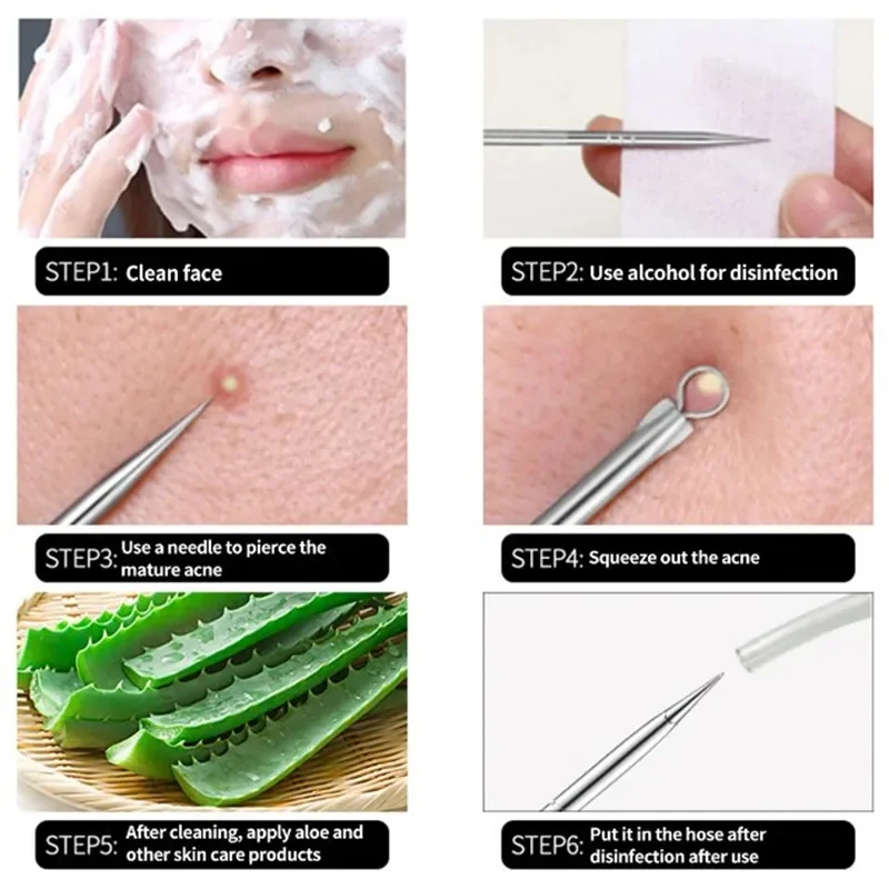 Beauty Acne Treatment Pore Cleanser Needle Hook 4PCS Acne Blackhead Comedone Black Spot Pimple Blemish Remover Skin Care Women