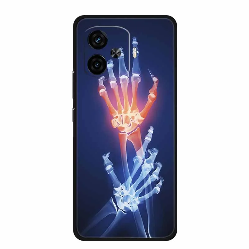 6.78 "ل Vivo iQOO Z9 توربو حافظة Z 9 توربو غطاء الهاتف أسود سيليكون لينة حالات ل Vivo iQOO Z9 توربو الغطاء الخلفي قذيفة