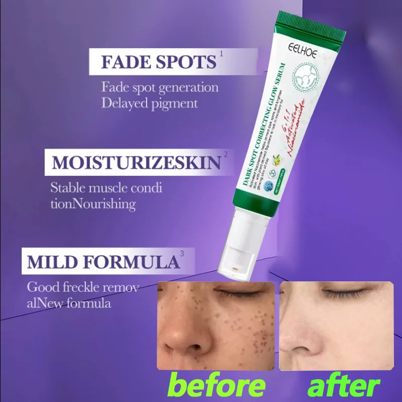 

Dark Spot Removal Serum Effectively lightens and diminishes dark spots smoothen & refines the skin's texture Moisturizing Repair