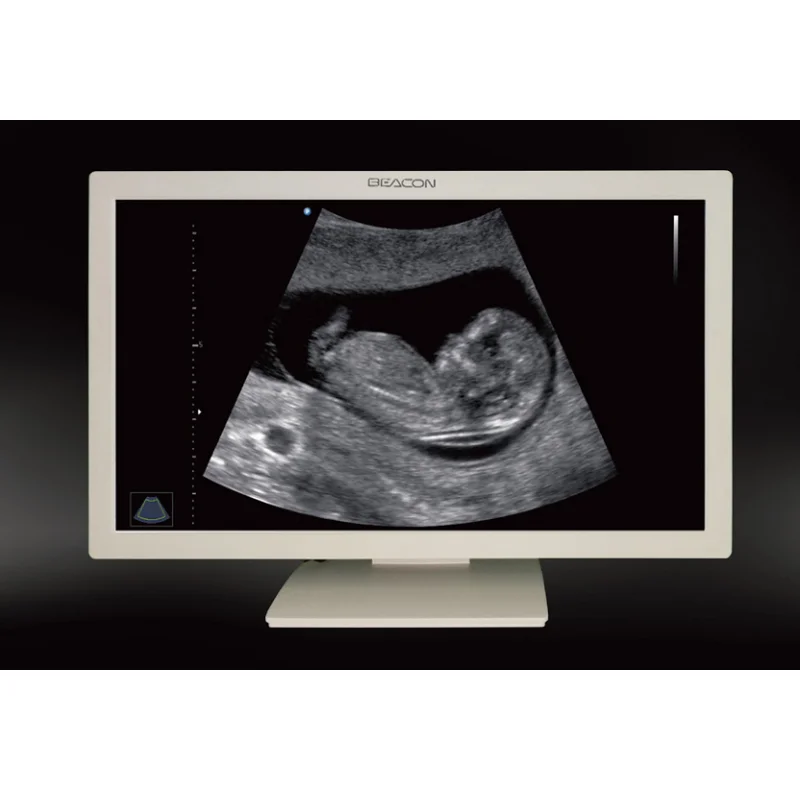 U2221 wide viewing angle Readable Display  21.5" Ultrasonic medical display Can be customized
