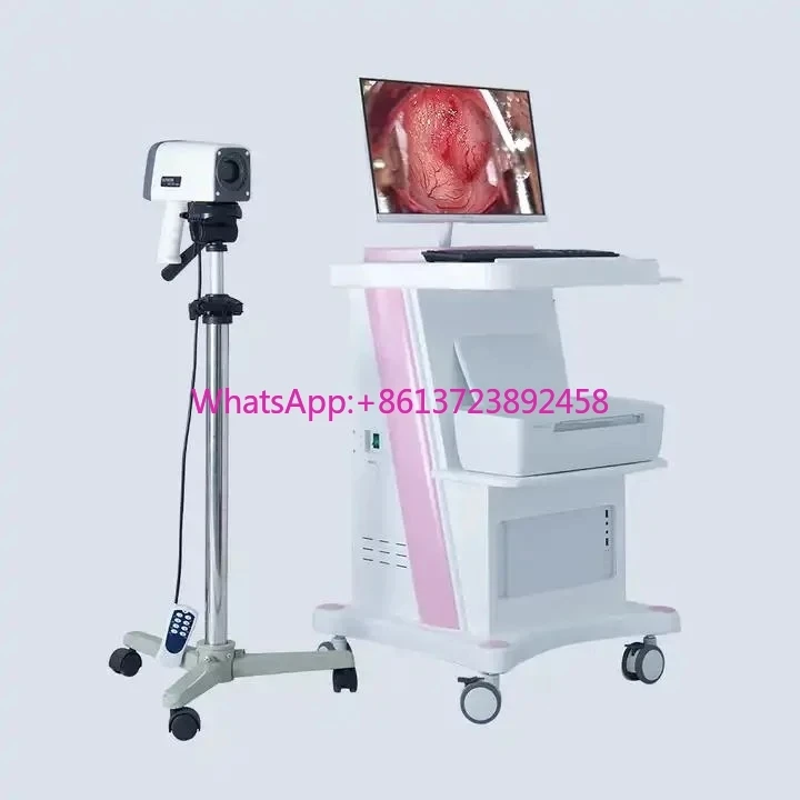 Mobile Digital Video Colposcope for Vaginal Gynecology