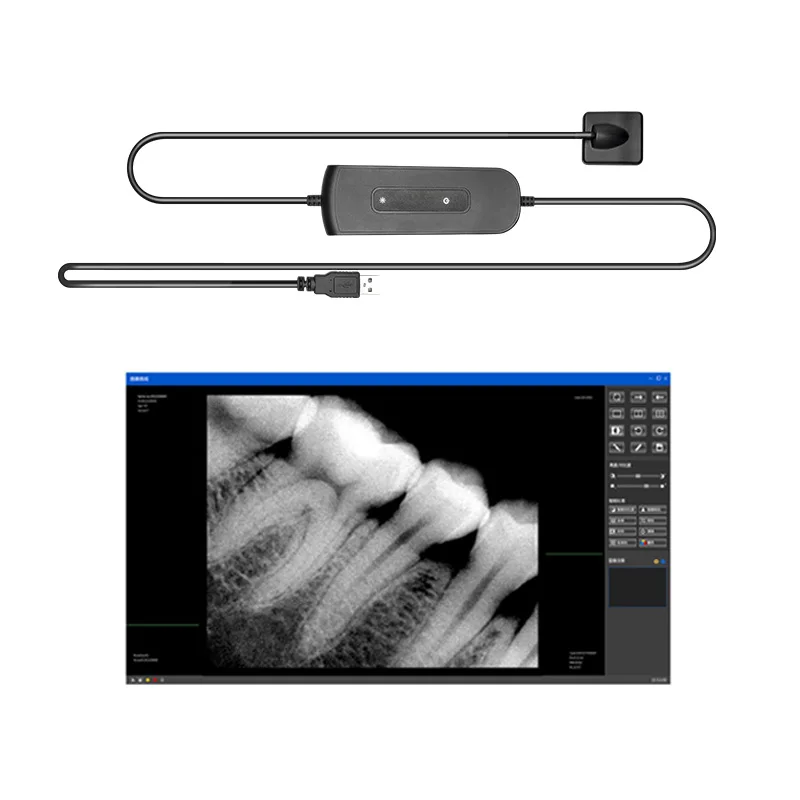 Digital cameras Dental Sensor X-Ray Radiovisiograph Digital Sensor Intraoral Imaging System HD Image Dentistry Tool