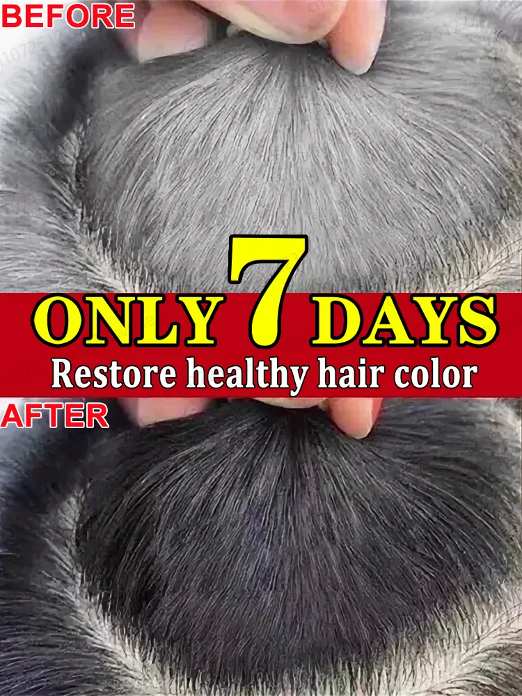 ᴺᵃᵗᵘʳᵃˡ ᴬⁿᵗⁱ⁻ᴳʳᵃʸ ᴴᵃⁱʳ ᔆᵉʳᵘᵐ⠘ ᴿᵉˢᵗᵒʳᵉ ᴰᵃʳᵏ ᴴᵃⁱʳ ᵃⁿᵈ ᴾʳᵉᵛᵉⁿᵗ ᴾʳᵉᵐᵃᵗᵘʳᵉ ᴳʳᵃʸⁱⁿᵍ ⁻ ⱽⁱᵗᵃˡⁱᵗʸ ᶠᵒʳᵐᵘˡᵃ