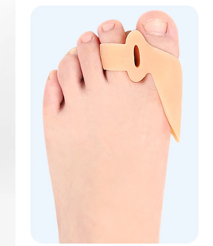 1/5Pairs Silicone Gel Thumb Corrector Bunion Foot Toe Hallux Valgus Protector Separator Foot Care Finger Straightener Adjuster 2