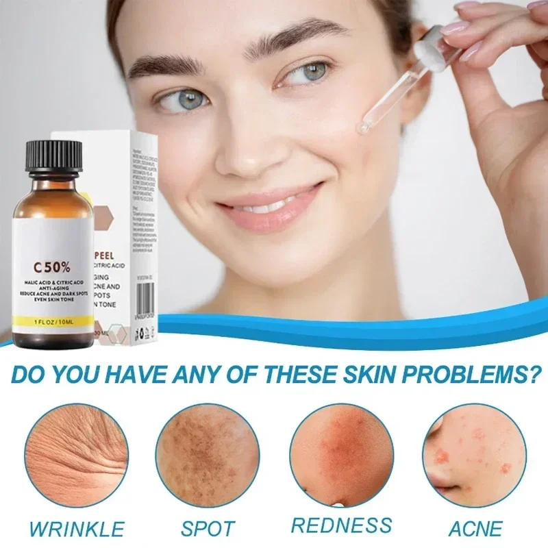 

With Malic Acid And Citric Acid For Face Facial Peel 40% Peeling Serum Peeling Serum Chemical Peel1