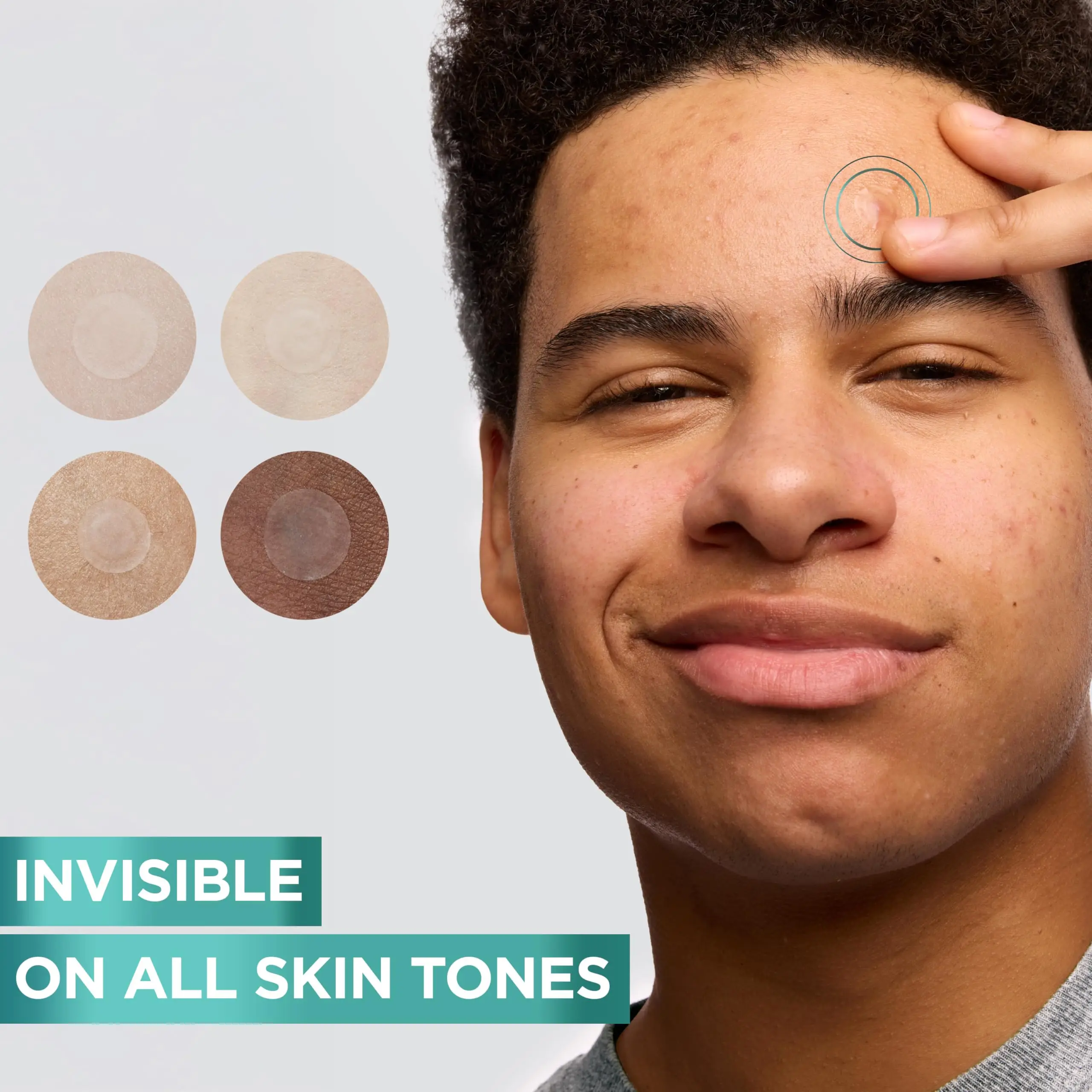 Набор смешанных патчей от прыщей в горошек, 360/720 шт., различные размеры, глубоко очищающие, без спирта, приятные для кожи, унисекс, для скрытия прыщей