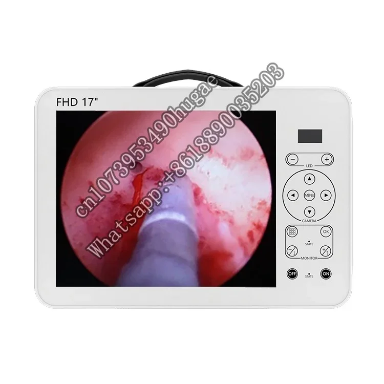 portable endoscopic video tower shrek fhd medical