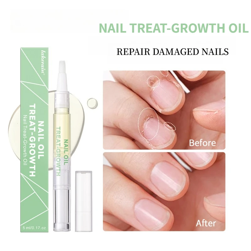 Penna a olio per cuticole per unghie – Rinforzante naturale per unghie e trattamento della crescita, ripara le unghie danneggiate, promuove la crescita e illumina