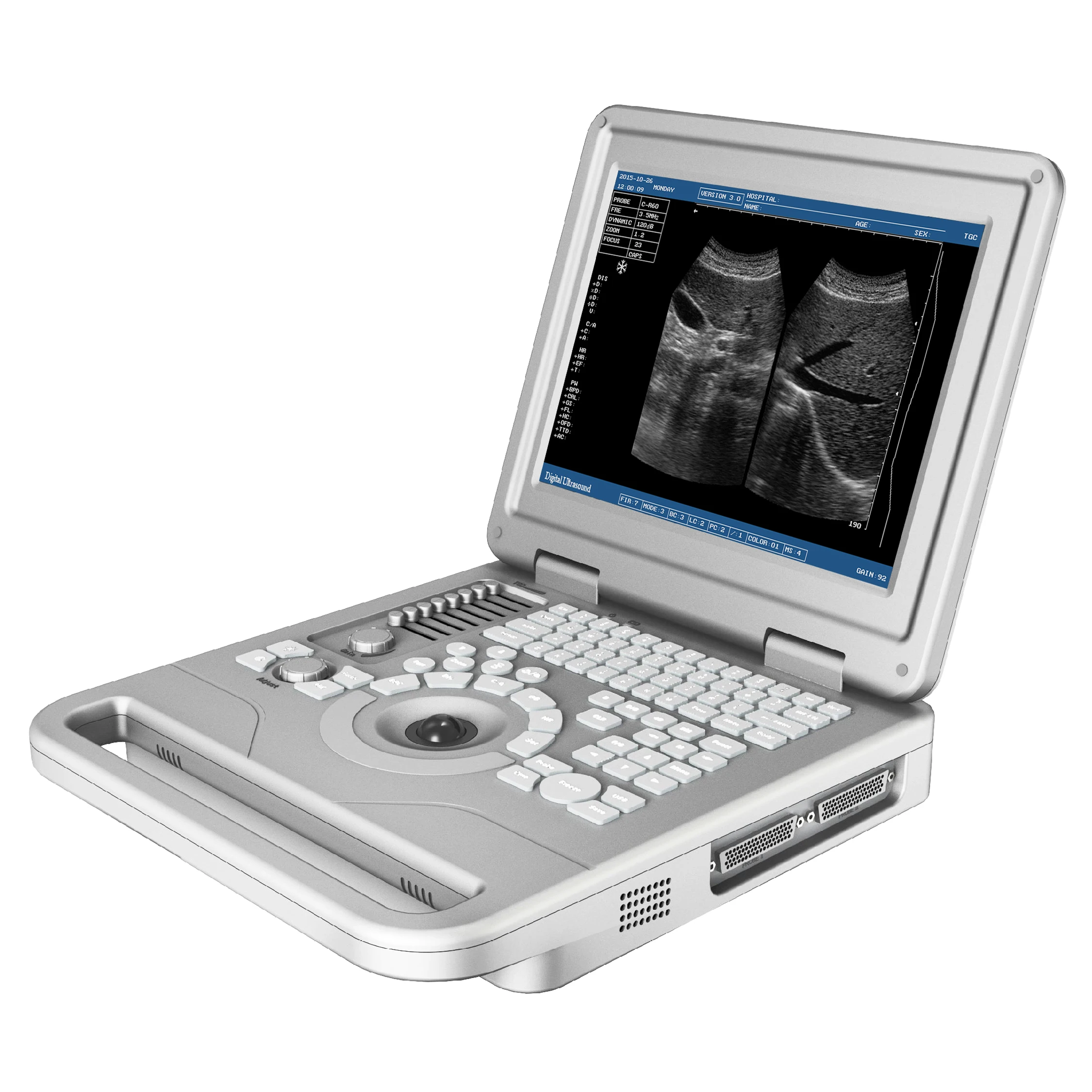 

Professional Medical Notebook Digital 12.1 Inch LCD Black White Diagnosis Equipment Laptop Ultrasonic System Ultrasound Scanner