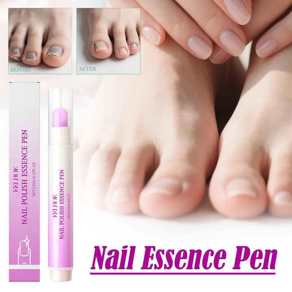 Stylo à Essence de vernis à ongles, adoucit l'élimination des peaux mortes, hydratant, nourrissant, armure de bord, renforce l'armure de levage, soins portables des ongles