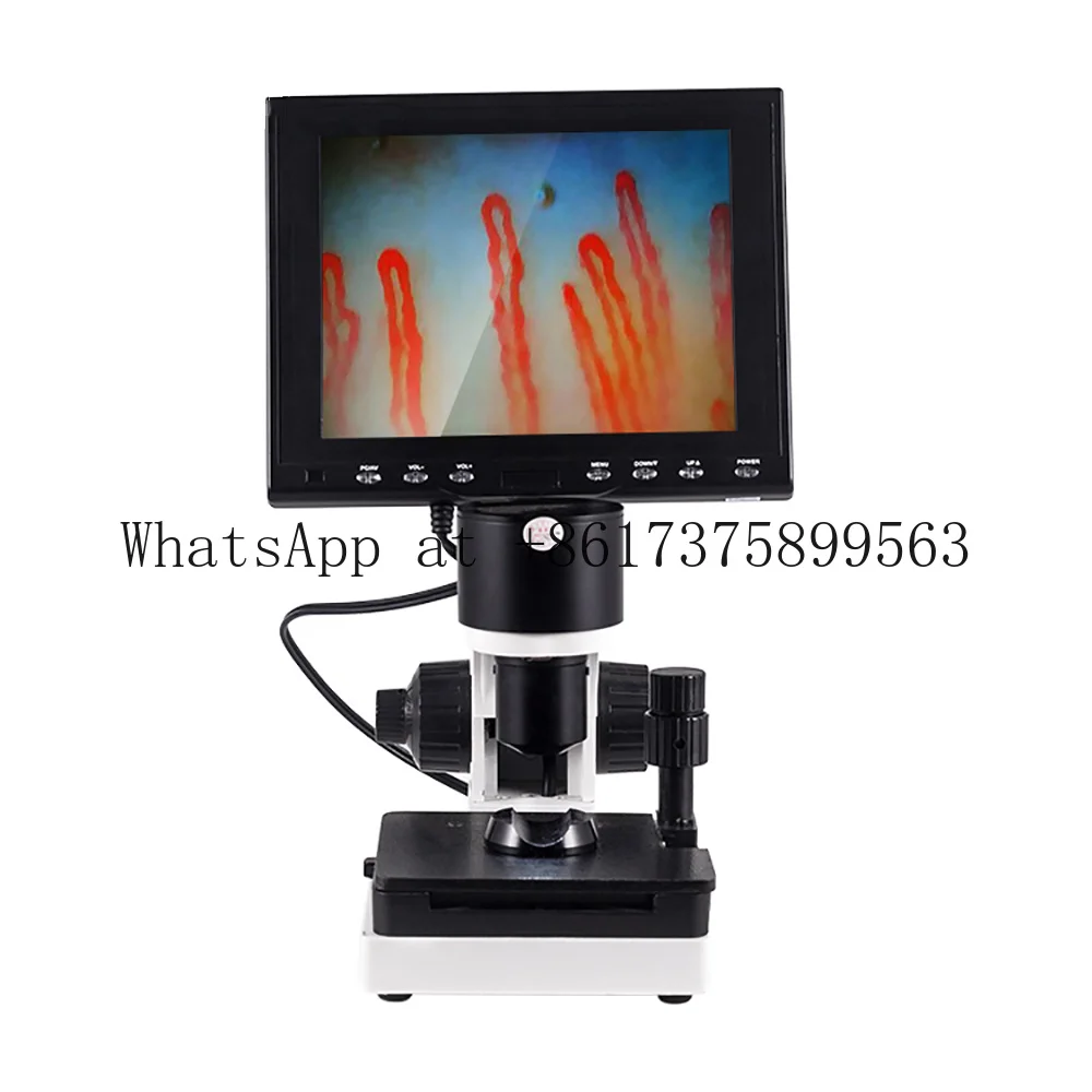 380000 Pixels 400 Times Nailfold Capillaroscopy Microcirculation  Capillary Microscope Subhealth Detector