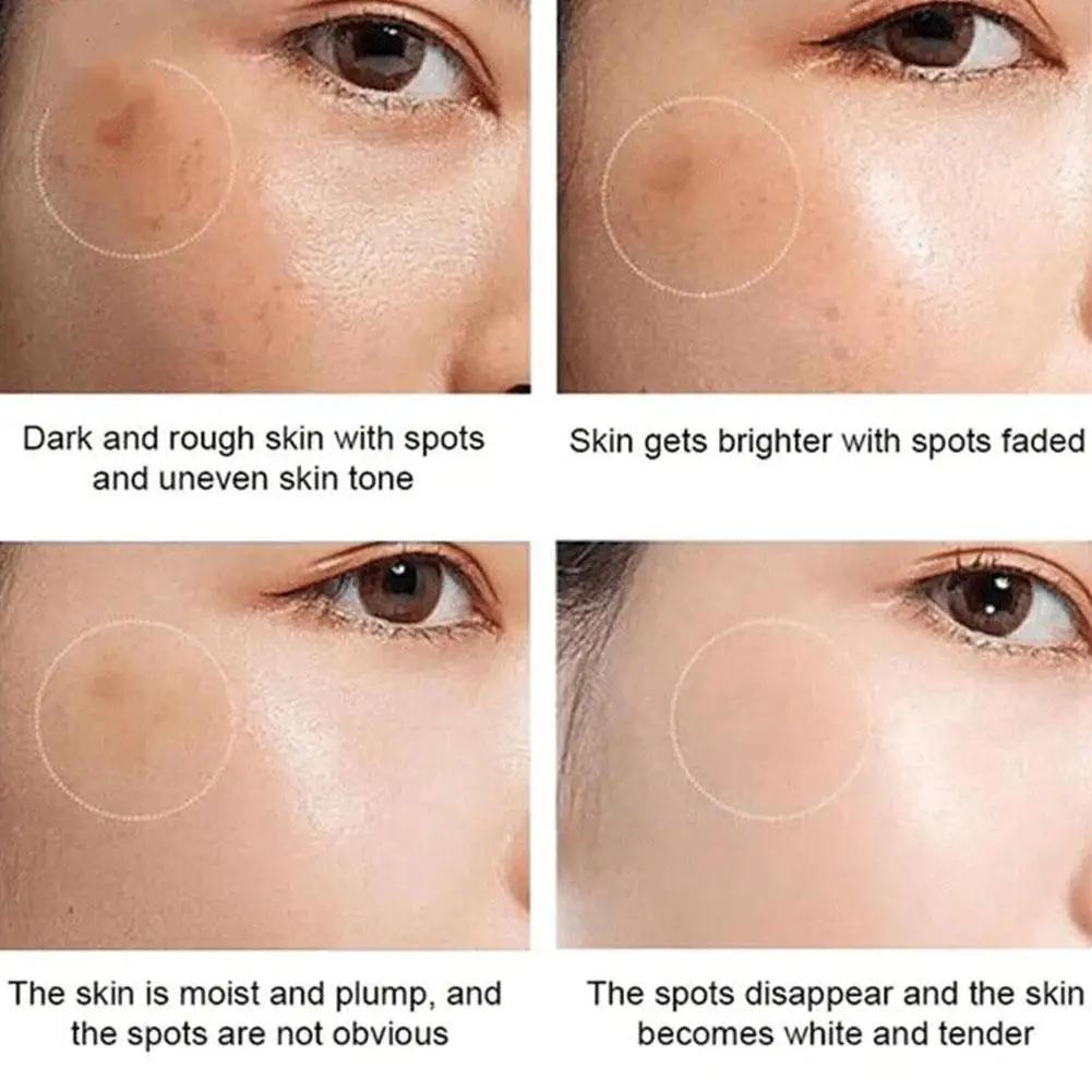 Yunnan Herbal Whitening Freckle Removal Cream Lighten Dark Spots Moisturizing Brightening Skin Tone Skin Care Products 20g