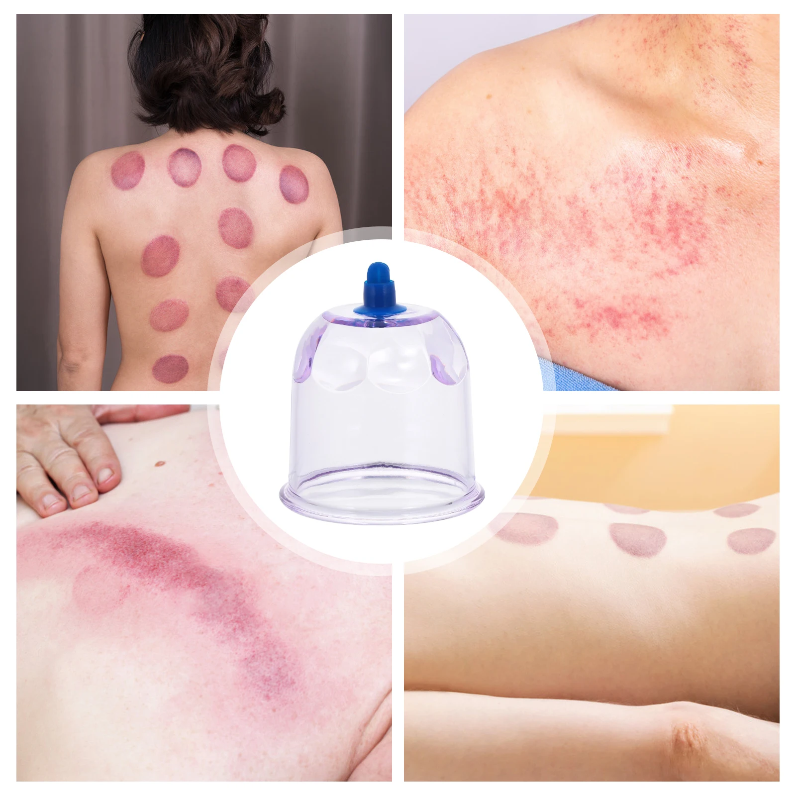 

Vacuum Cupping Cups Moxibustion Physiotherapy Cup Vacuum Suction Cup Household Cupping Jars Moxibustion Therapy Cans