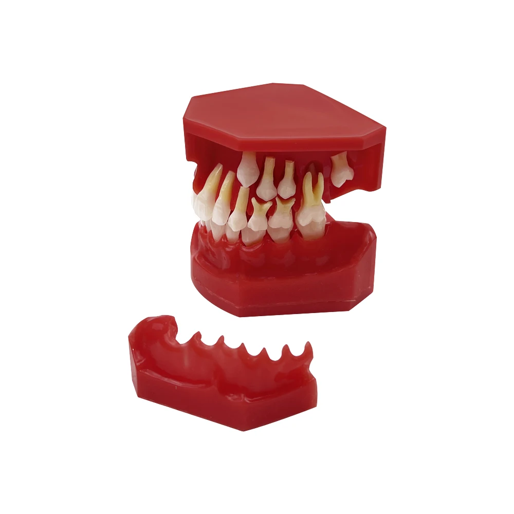 Child Caries Dental Model Primary Permanent Teeth Alternate Model Replacement Teeth Development Demonstration Model Materials