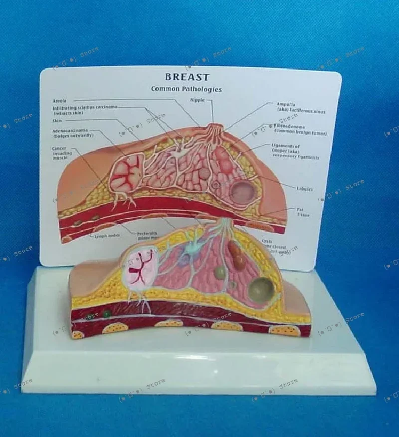 

breast model hyperplasia housekeeping training maternity breast demonstration lactation structure prolactist teaching aids