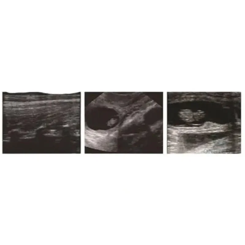 SY-W4409 Portable Black White Veterinary Ultrasound Scanner For Small Animals And Equine
