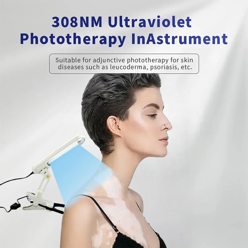 308nm UVB ultraviolet light therapy instrument for vitiligo treatment UV lamp laser vitiligo light treatment for psoriasis