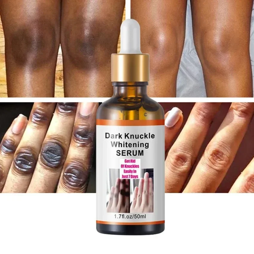 Private Label Dark Knuckles Whitening Serum Pigmentation Correctors for Hand and Finger Joint Remover Foundation Bulk Makeup