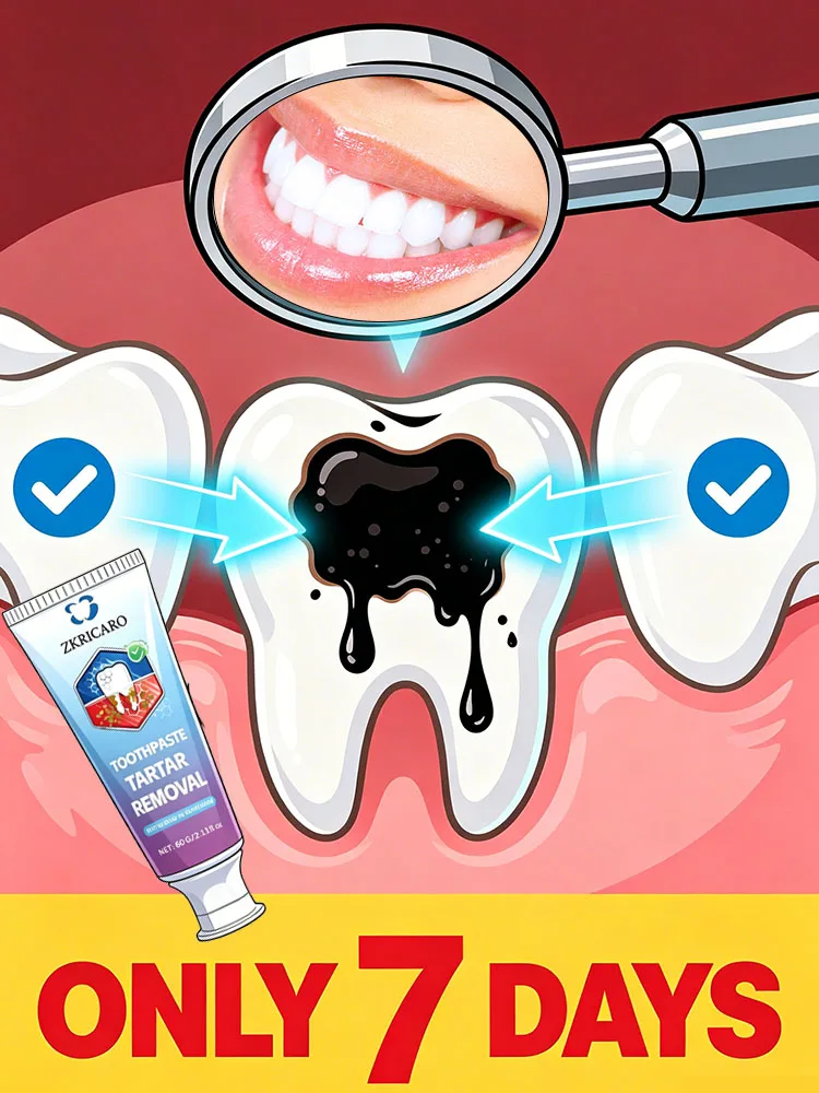 POZOAMIS Chlorine Toothpaste Removes Tartar Cavities Disappearance Cleans The Mouth Freshens Breath Whitens Teeth Gum Care Accessories Suitable For Home Use