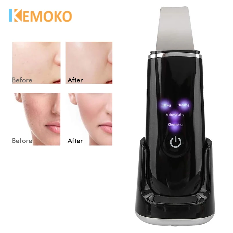 Electric Ultrasonic Skin Deep Cleaning Peeling Shovel Facial Skin Care Face Lifting Machine Ultrasonic Cleaner Beauty Machine