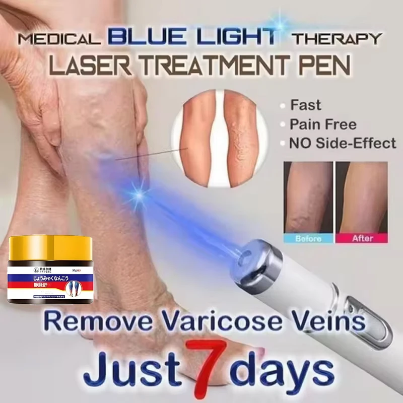 

HF03 Upgraded Varicose Vein Laser Pen Can Treat Spider Veins in Legs and Improve Blood Flow in Leg Blood Vessels
