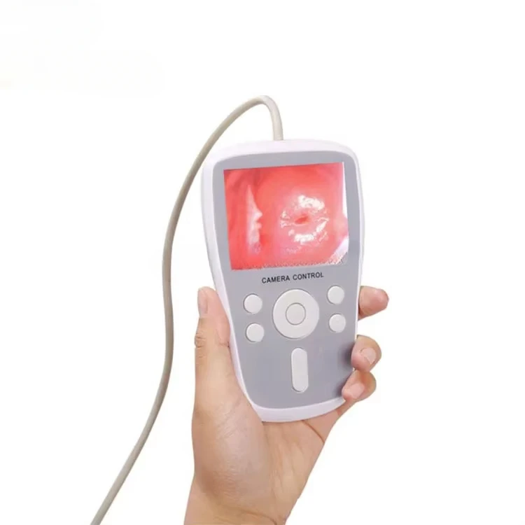 YSPL9800B Ysenmed Hot sale portable mini vaginal speculum gynecology equipment  trade Handheld vaginal video vaginal speculum