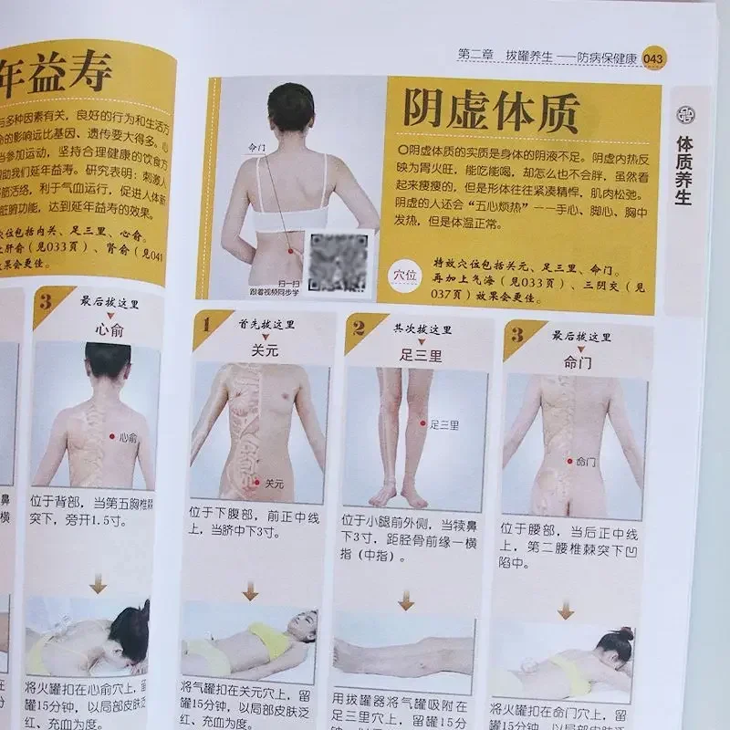 Schröpfen Gesundheit Körper Entfernung Buch Illustrierte TCM Akupunkturpunkt Null-basierte Schröpfen Einführung Schröpfen Technik Tutorial