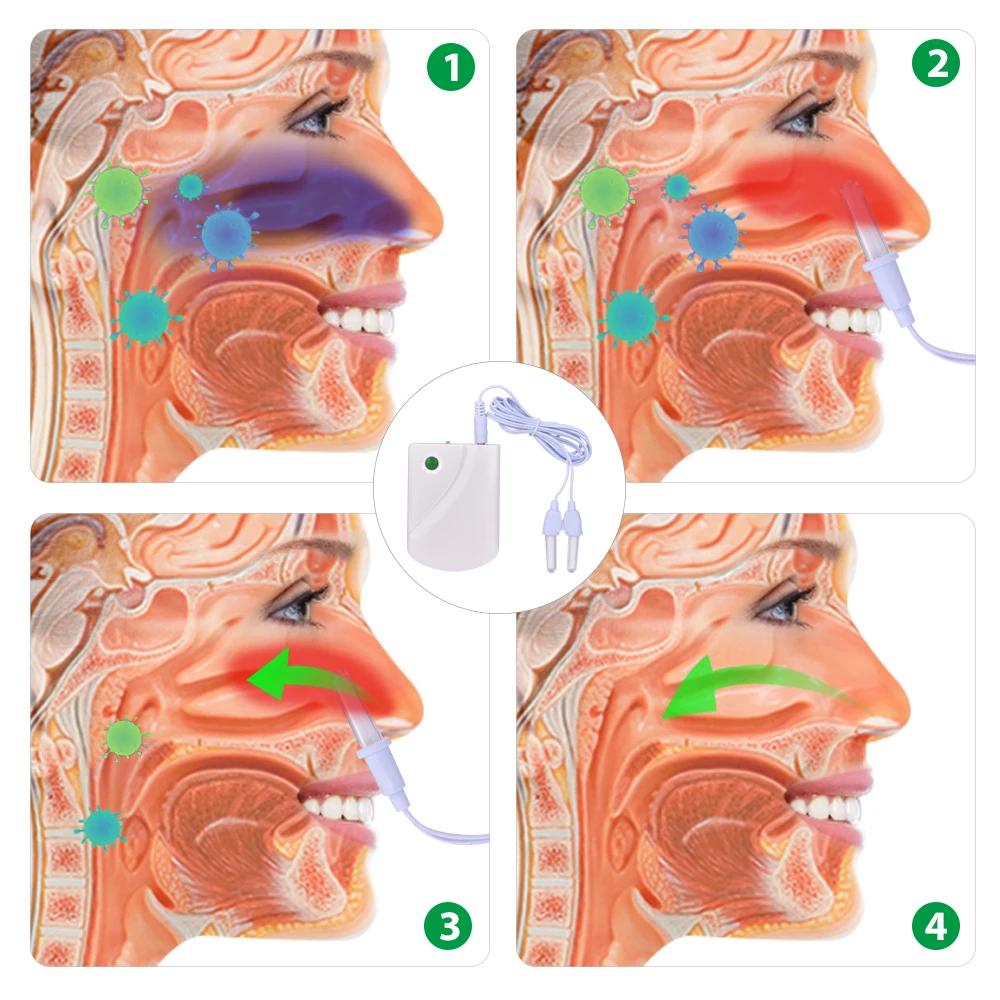 Nose Care Rhinitis Therapy Allergy Reliever Low Frequency Laser Allergy Rhinitis Sinusitis Anti-Snoring Treatment Device Massage