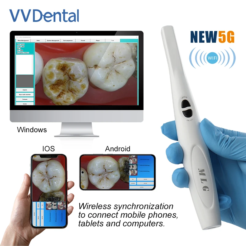 VV Dental Wireless Ultra HD Intra Oral Camera 1300W Pixel with 6 LED White Light Wifi Endoscope For Dentistry Teeth Inspection