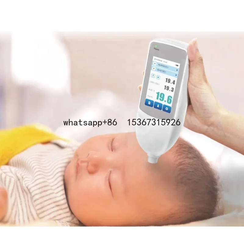 infant neonatal bilirubin meter transcutaneous jaundice meter